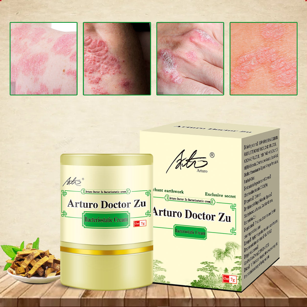 ✅Arturo 7g 100% Effective Original Arturo Doctor Zu Skin Herbal Psoriasis Dermatitis Eczema Pruritus Psoriasis Cream Ointment Exclusive Formula Made With Natural Herbs
