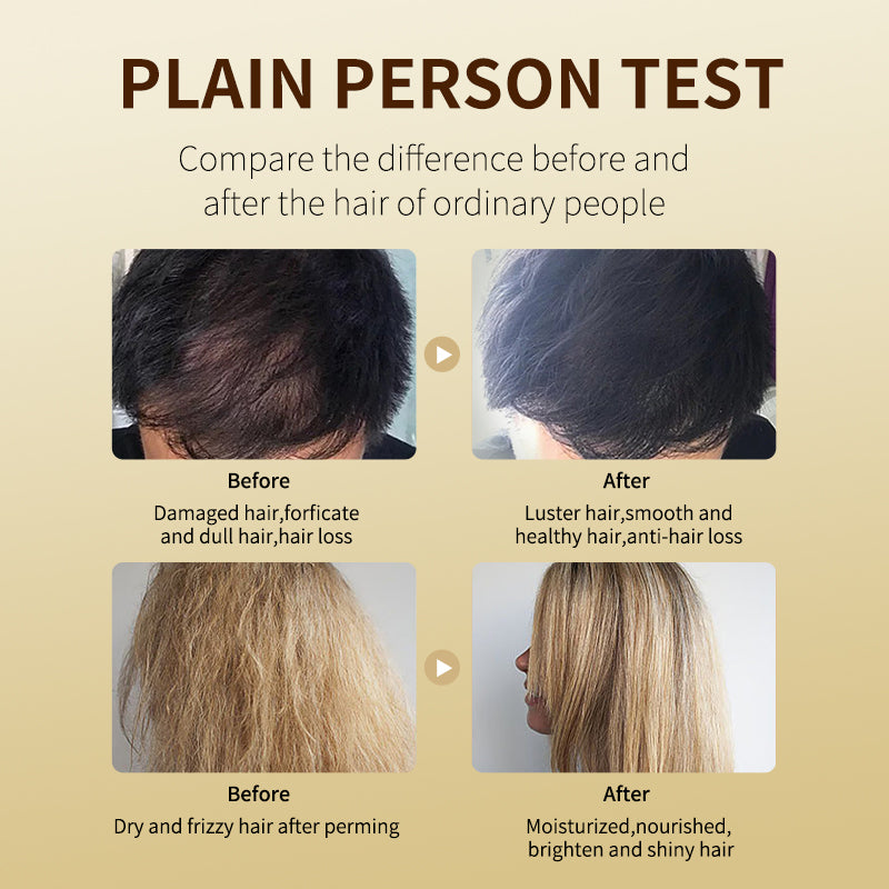 Arturo Zudaifu 500ML Professional Ginger Hair Shampoo Anti Hair Loss Nourish Hair Fast Regrowth Oil Control Care