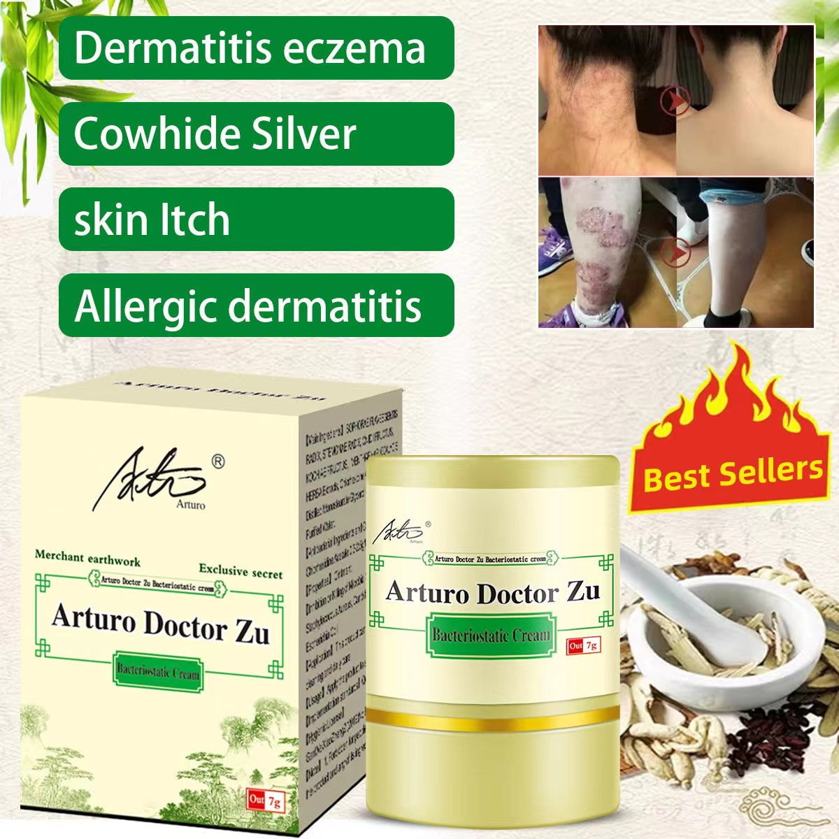 ✅Arturo Buy 1 take 6 7g 100% Effective Original Arturo Doctor Zu Skin Herbal Psoriasis Dermatitis Eczema Pruritus Psoriasis Cream Ointment Exclusive Formula Made With Natural Herbs